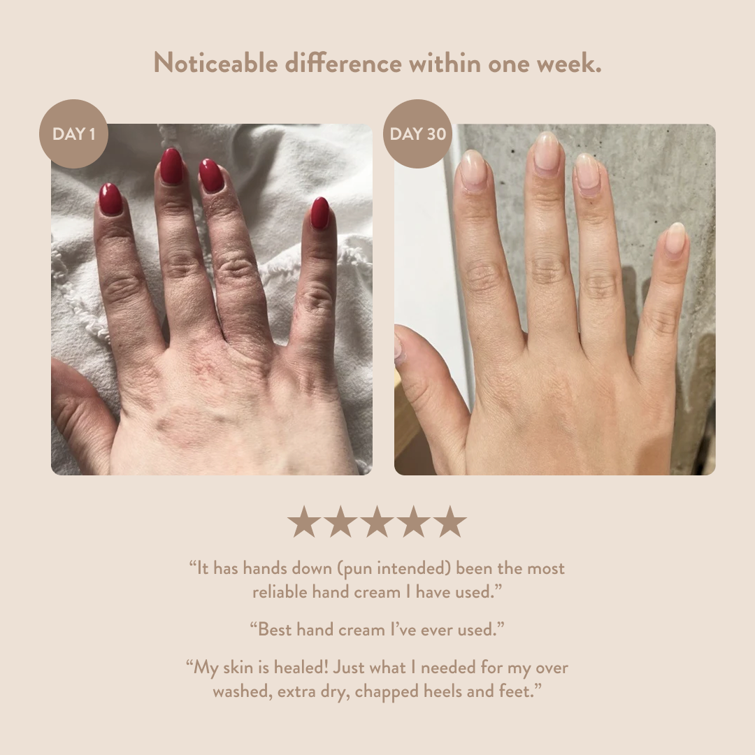 Overnight Hand & Foot Hydration Mask: 3.4oz