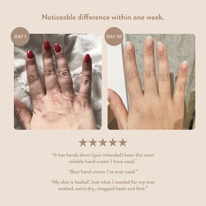 Overnight Hand & Foot Hydration Mask: 3.4oz